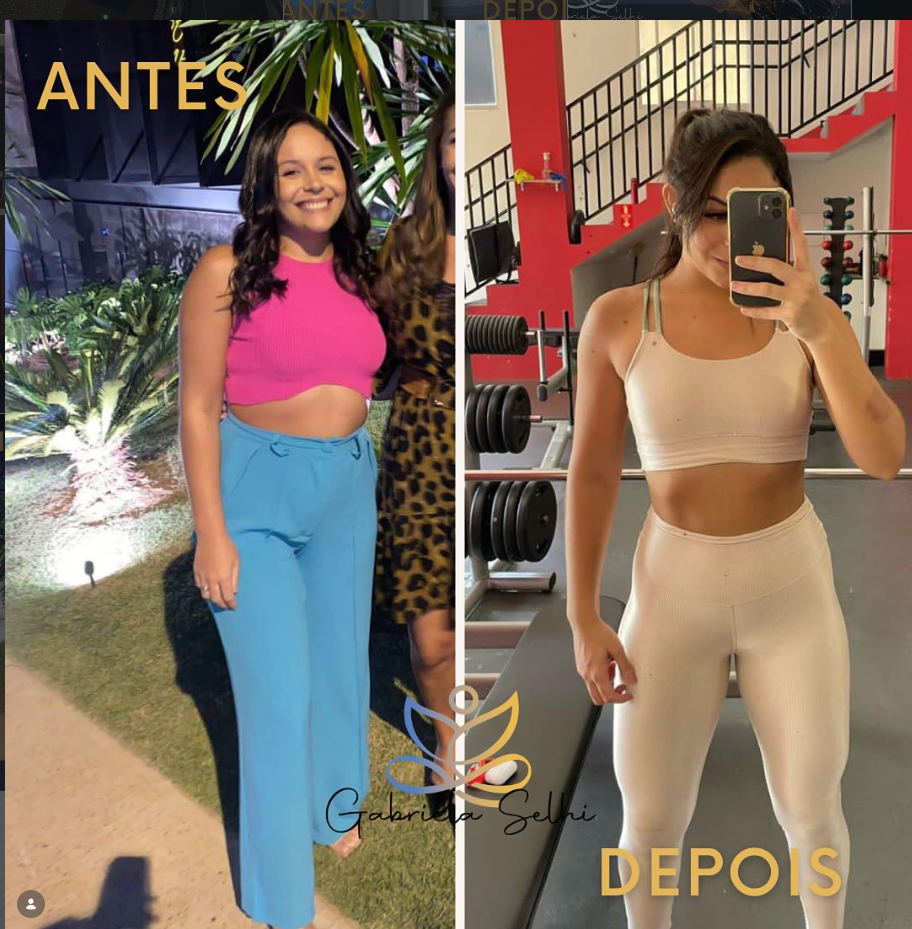 Antes e depois — resultado 4